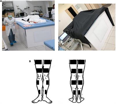 Sensitivity of Visual System in 5-Day “Dry” Immersion With High-Frequency Electromyostimulation